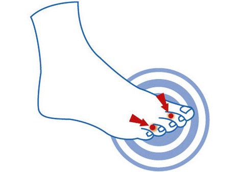 Gesunder Fuß - epitact Zehendruckschutzpolster, in Größe 1 (für Damen) bis 2 (für Herren), in Farbe HAUT Ansicht 2