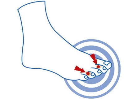 Gesunder Fuß - epitact Zehendruckschutzpolster, in Größe 1 (für Damen) bis 2 (für Herren), in Farbe HAUT – Farbe HAUT – Ansicht 