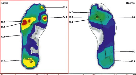 Schuheinlagen - Orthopädische Weichpolstersohle – Farbe BLAU/SCHWARZ – Ansicht  Schuheinlagen - Orthopädische Weichpolstersohle, in Größe 001 bis 006, in Farbe BLAU/SCHWARZ – Farbe BLAU/SCHWARZ – Ansicht
