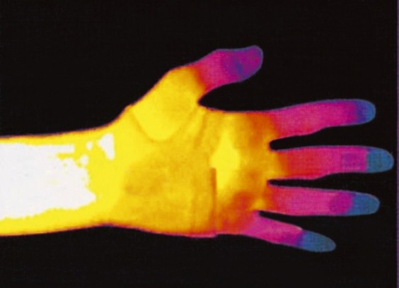 Bandagen - Bandagen in verschiedenen Ausführungen, in Größe 001 bis 002, in Farbe CREME, in Ausführung Kniegelenkbandage Ansicht 4