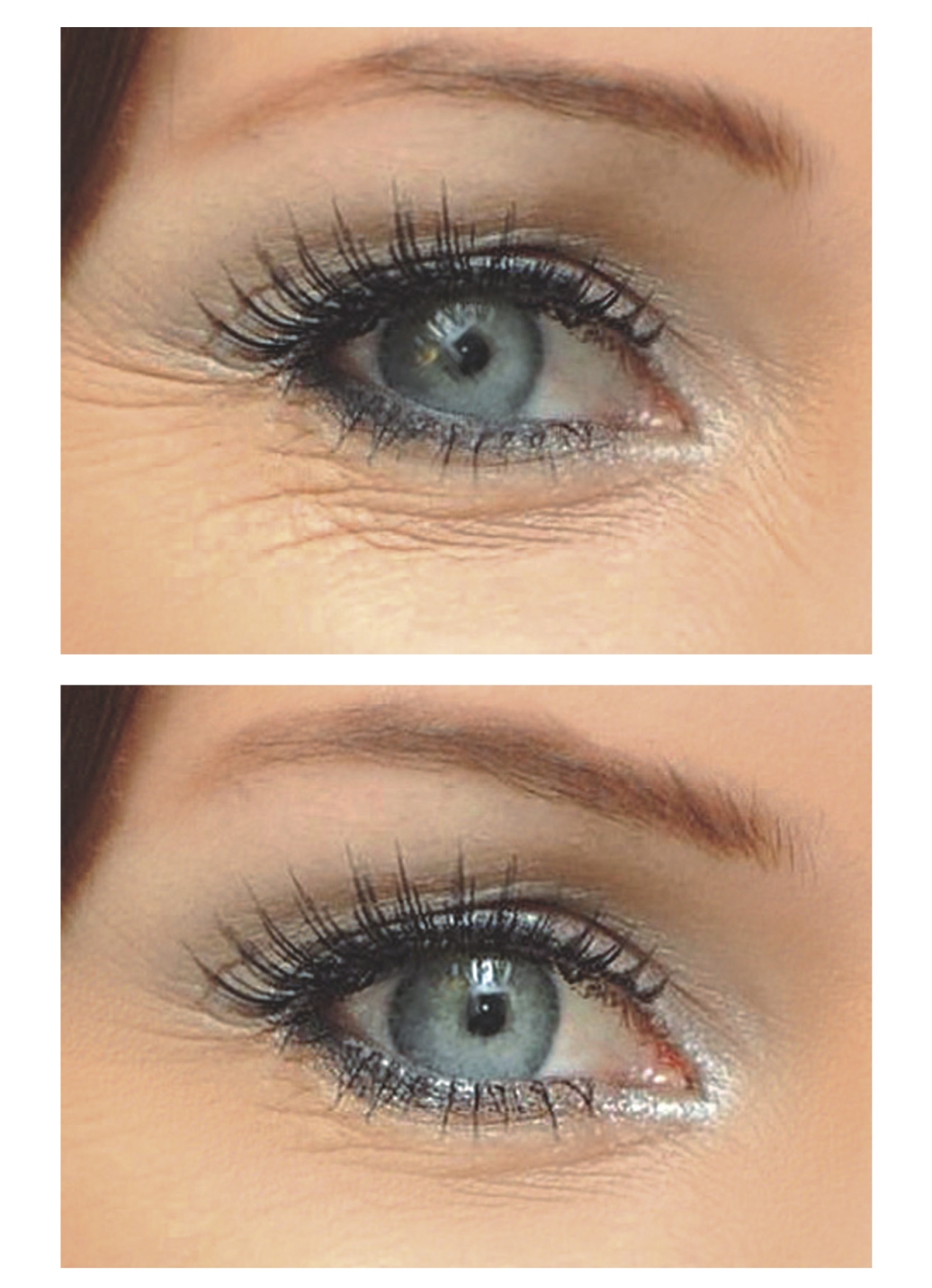 How To Get Rid Of Premature Wrinkles Under Eyes Naturally How To Get Rid Of Premature Wrinkles Under Eyes Naturally
