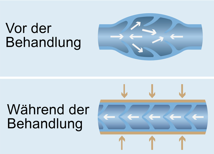 - Vitalmaxx Venenwalker Basic Venen-Massagegerät, in Farbe TÜRKIS Ansicht 2