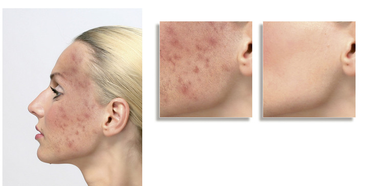 Körperpflege & Kosmetik - ELITE Cover Make-up, in Farbe DUNKEL Ansicht 3