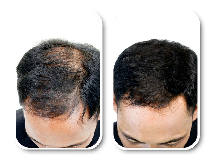 Haarstyling & Haarpflege - Velform® Nutritional Lotion für jeden Haartyp, in Farbe ROT-GRÜN Ansicht 2