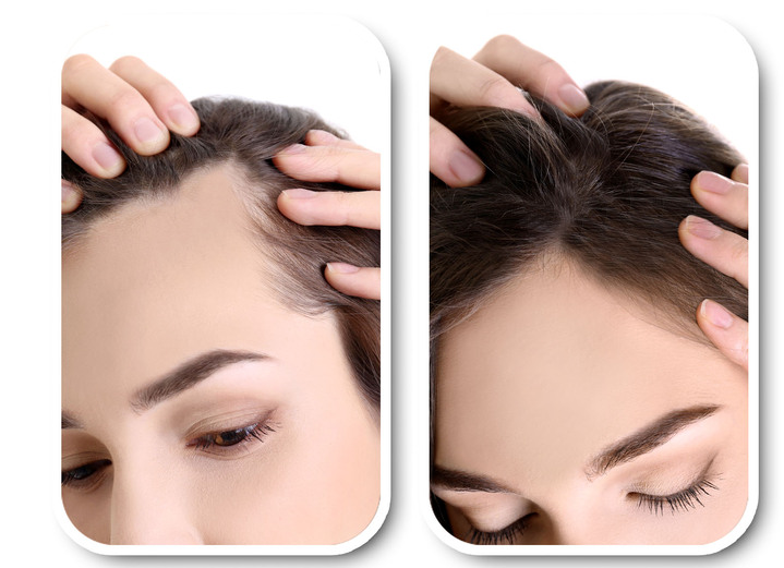 Haarstyling & Haarpflege - Velform® Nutritional Lotion für jeden Haartyp, in Farbe ROT-GRÜN Ansicht 3