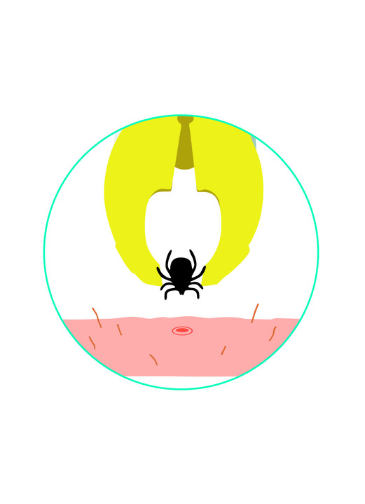 Sonstiges - Zeckengreifer, in Farbe WEISS Ansicht 3