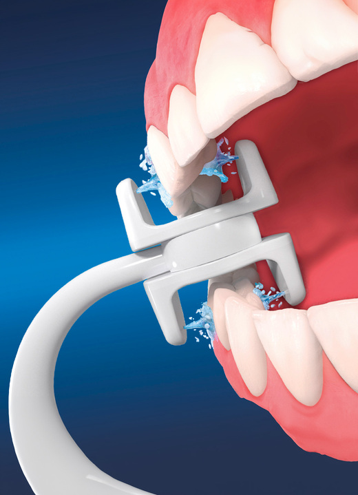 Sonstiges - Zusatzaufsätze für Munddusche Corp Care Miracle Smile, in Farbe WEISS, in Ausführung H-Förmige Reinigungsaufsätze, 2er-Set Ansicht 2