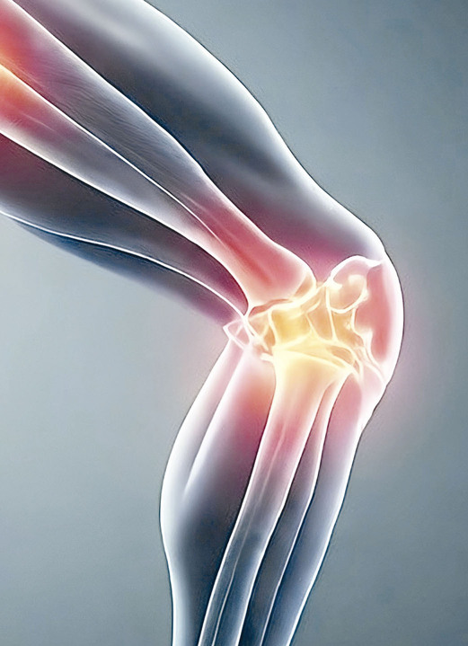 Bandagen - Knie- und Knöchelbandage, in Farbe ANTHRAZIT-SCHWARZ, in Ausführung Knöchelbandage Ansicht 3