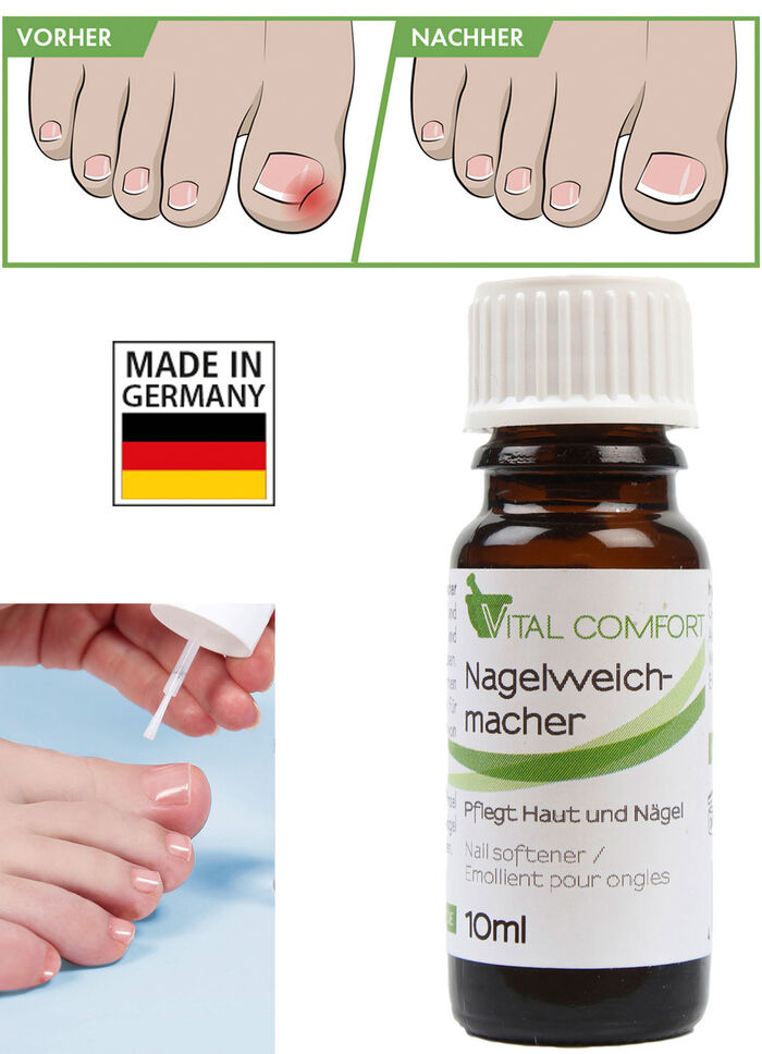 Nagelweichmacher 