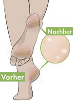 Fersen-Balsam 2er Set 