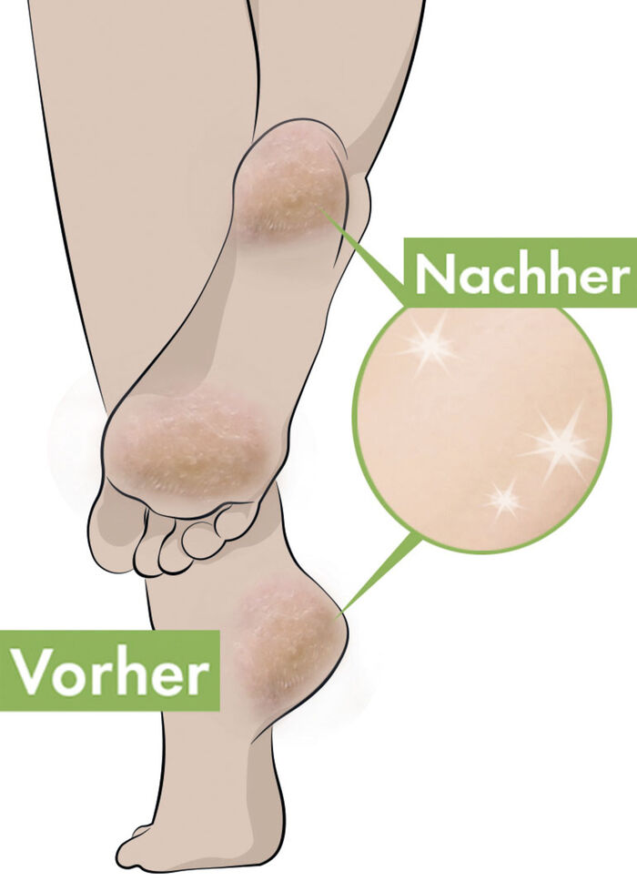 Fersen-Balsam 2er Set 