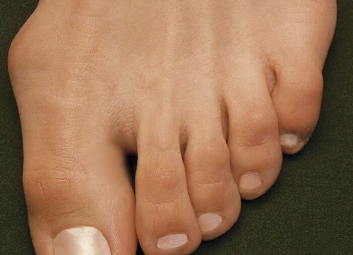 Aerosoft® Flex Stretch-Klettslipper von Jürgen Hirsch® BRAUN