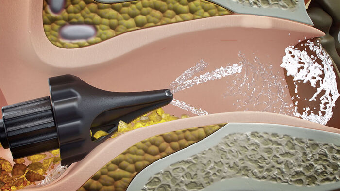 Elektrische Ohrendusche 